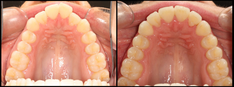 ortodoncija